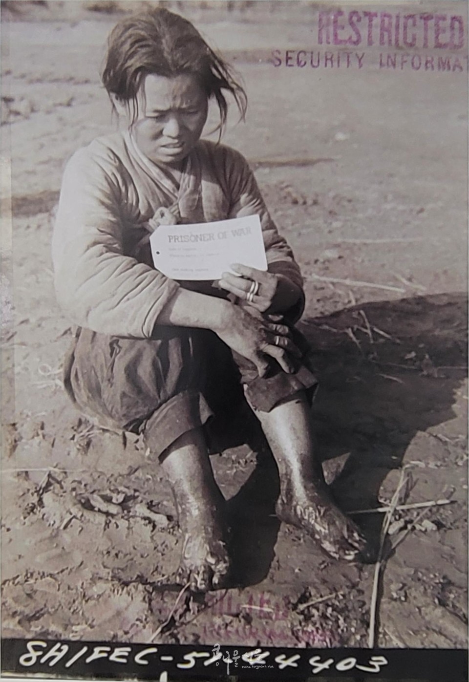 발에 동상을 입은 여성 빨치산 포로(1951년 12월 10일, 국군 수도사단 관할 수용소)
